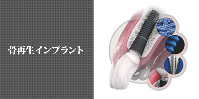 骨再生インプラント