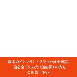 オールオン4・6