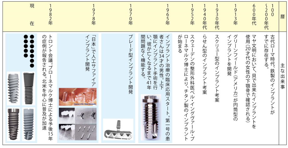 インプラント治療の歴史について詳しくはこちら